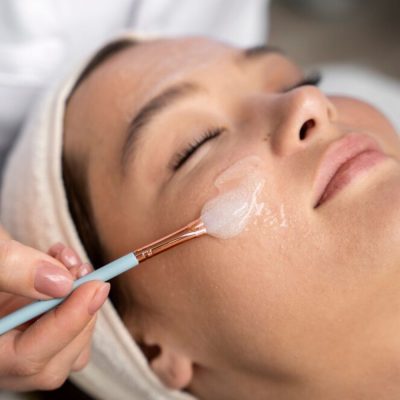 Chemical Peels