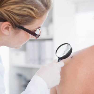 Diagnosis of Skin Growths