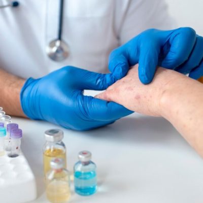 Diagnosis of Skin Infections