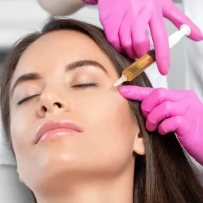 Facial Platelet-Rich Plasma (PRP) Therapy